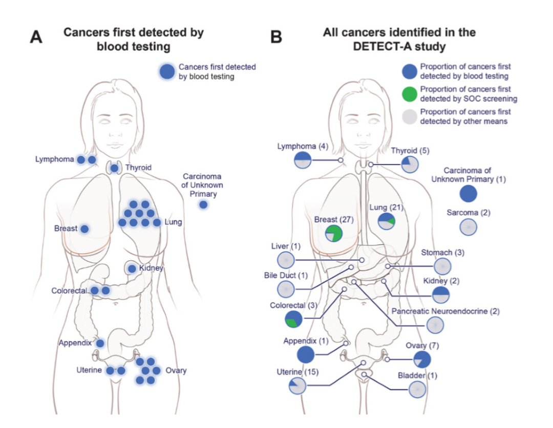 只有1%的假阳性率，血液检测可以更早的发现癌症