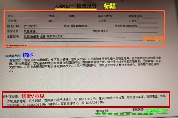 解密“天书”：分分钟学会解读乳腺影像学报告