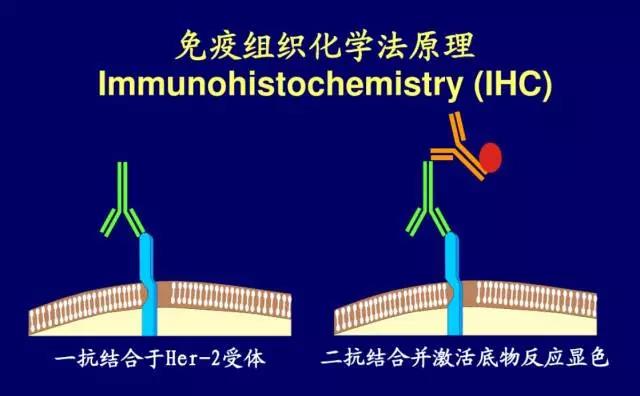 乳腺癌的免疫组织化学介绍