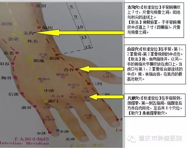 手部穴位操缓解强阿片类药物所致便秘