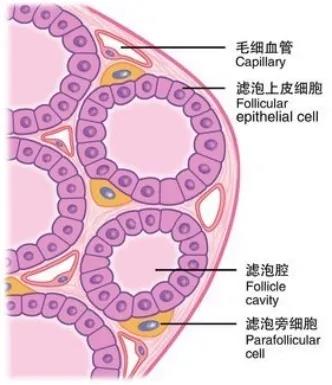 Lung Cancer pics