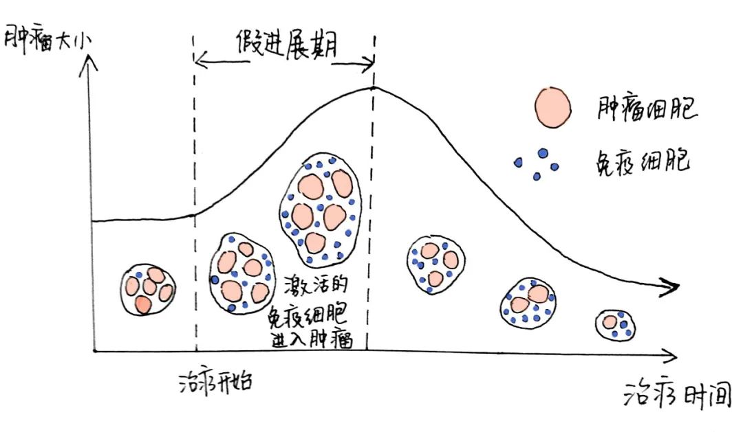 如何知道免疫治疗是否有效（下）？