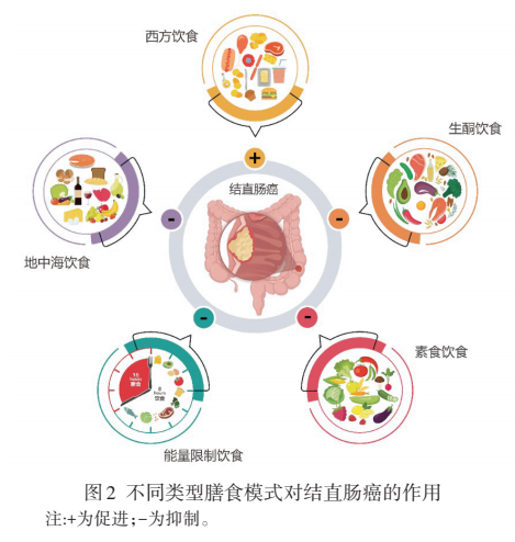 膳食模式、肠道菌群与结直肠癌