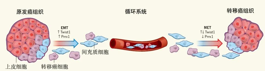 迄今为止最大研究数据揭示：循环肿瘤细胞CTC可预测转移性乳腺癌的