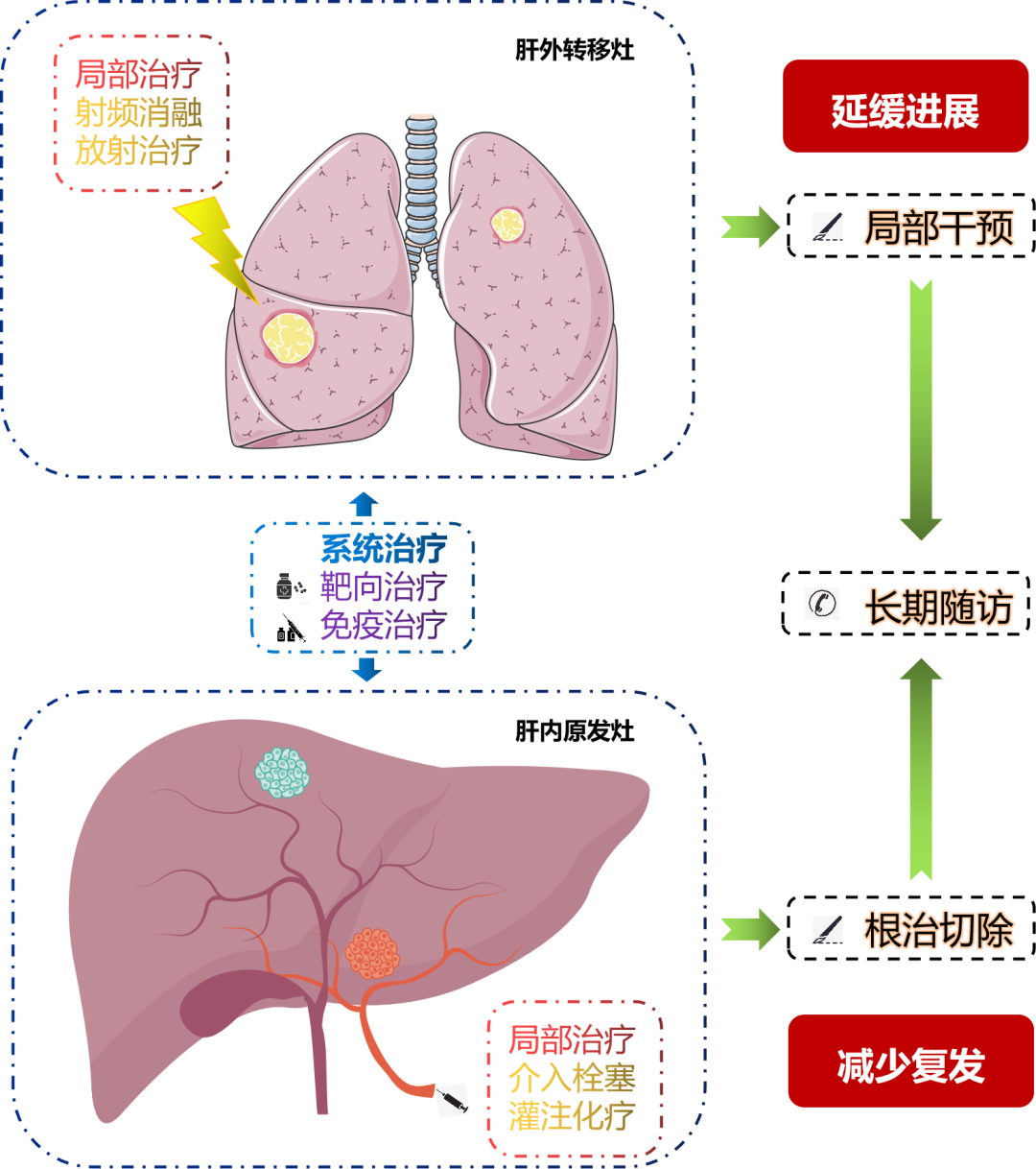 晚期肝癌远处转移，仍可转化治疗后手术切除？