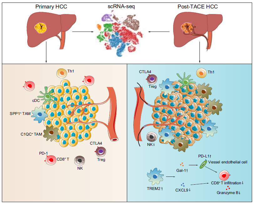 李家平教授团队揭示肝癌栓塞术后单细胞免疫微环境