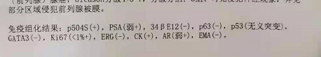 病理报告单上的免疫组化怎么看？一文教你看懂关于前列腺癌的这些指