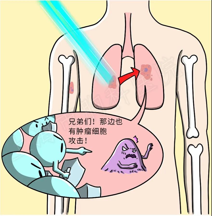 走近放疗（四）——放疗面对肺癌转移有什么方法？