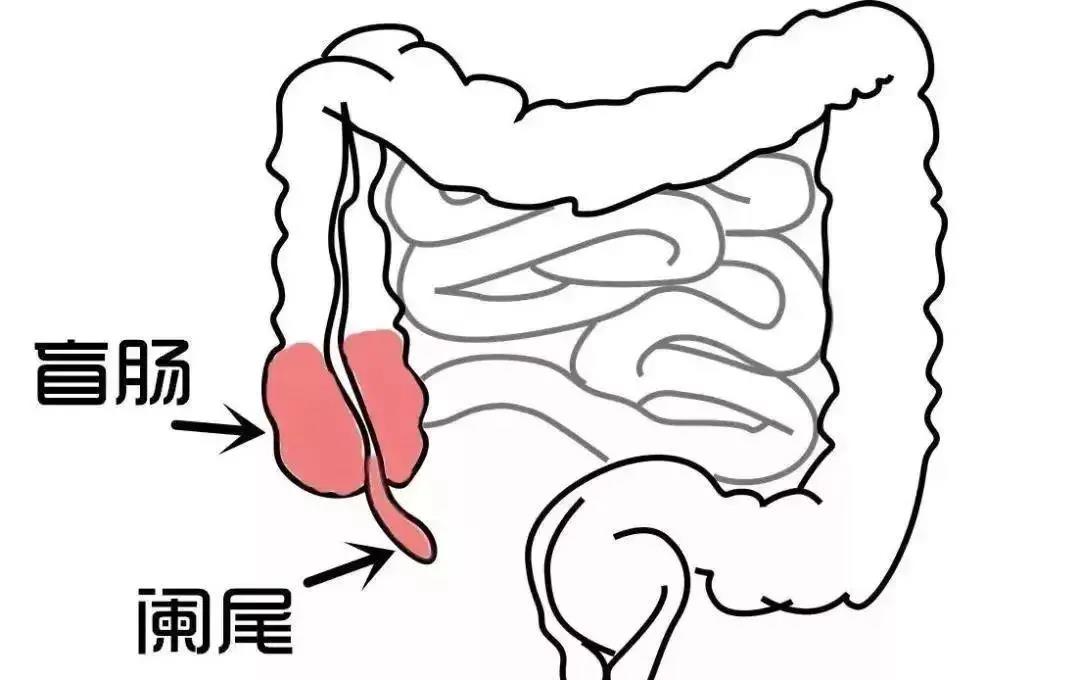 致命的误诊：「结肠癌」常常伪装成这些“良性病'!