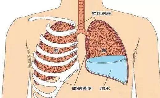 【术后】肺癌/肺结节术后不进行呼吸功能锻炼，风险到底有多大？