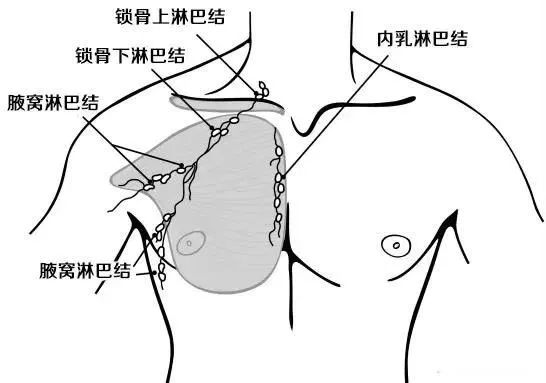 乳腺癌术后放疗，你首先要关注这 3 个问题