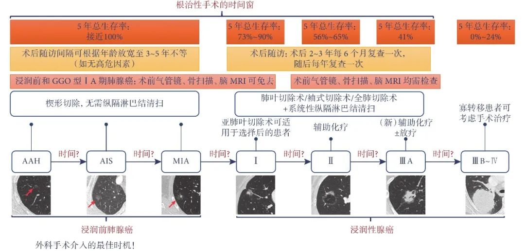 磨玻璃结节型肺癌患者的个体化全程管理策略