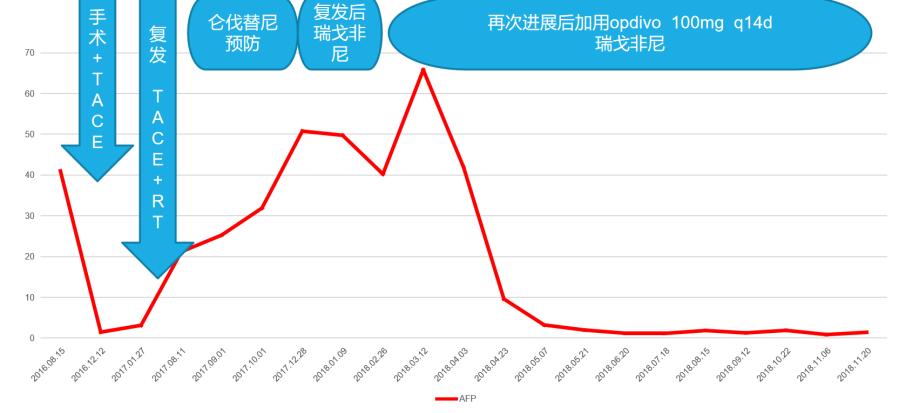 从还剩3个月到奔向第8年，手术+放疗+靶免“新三联”疗法给肝癌患者