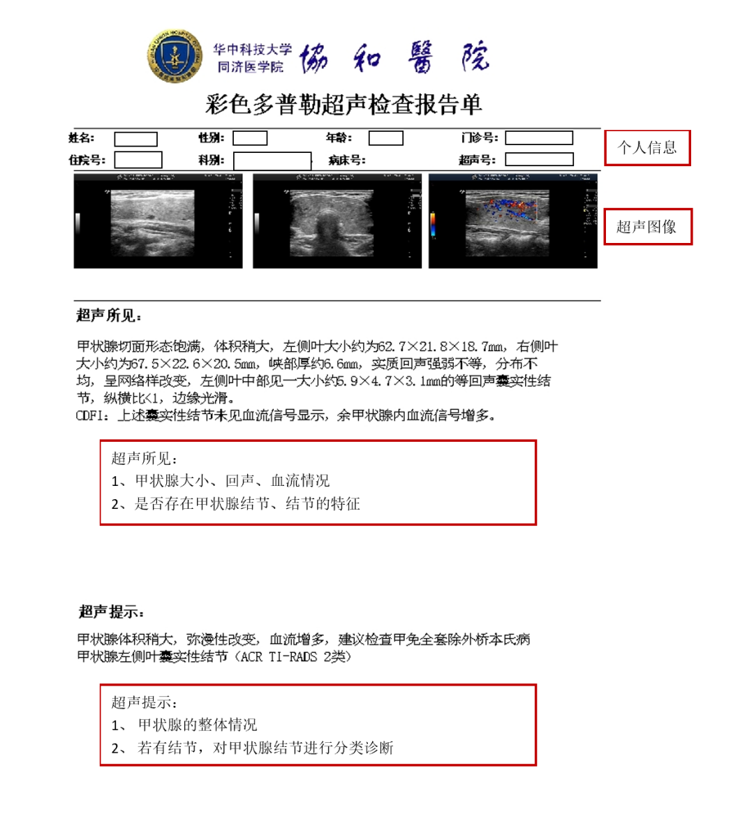 手把手教你看报告，早期识别甲状腺结节恶变信号